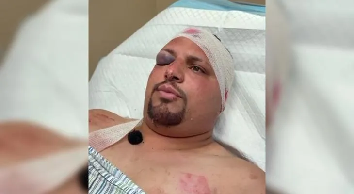 Violent Attack by Settlers in Deir Abu Mashal Leaves Four Injured