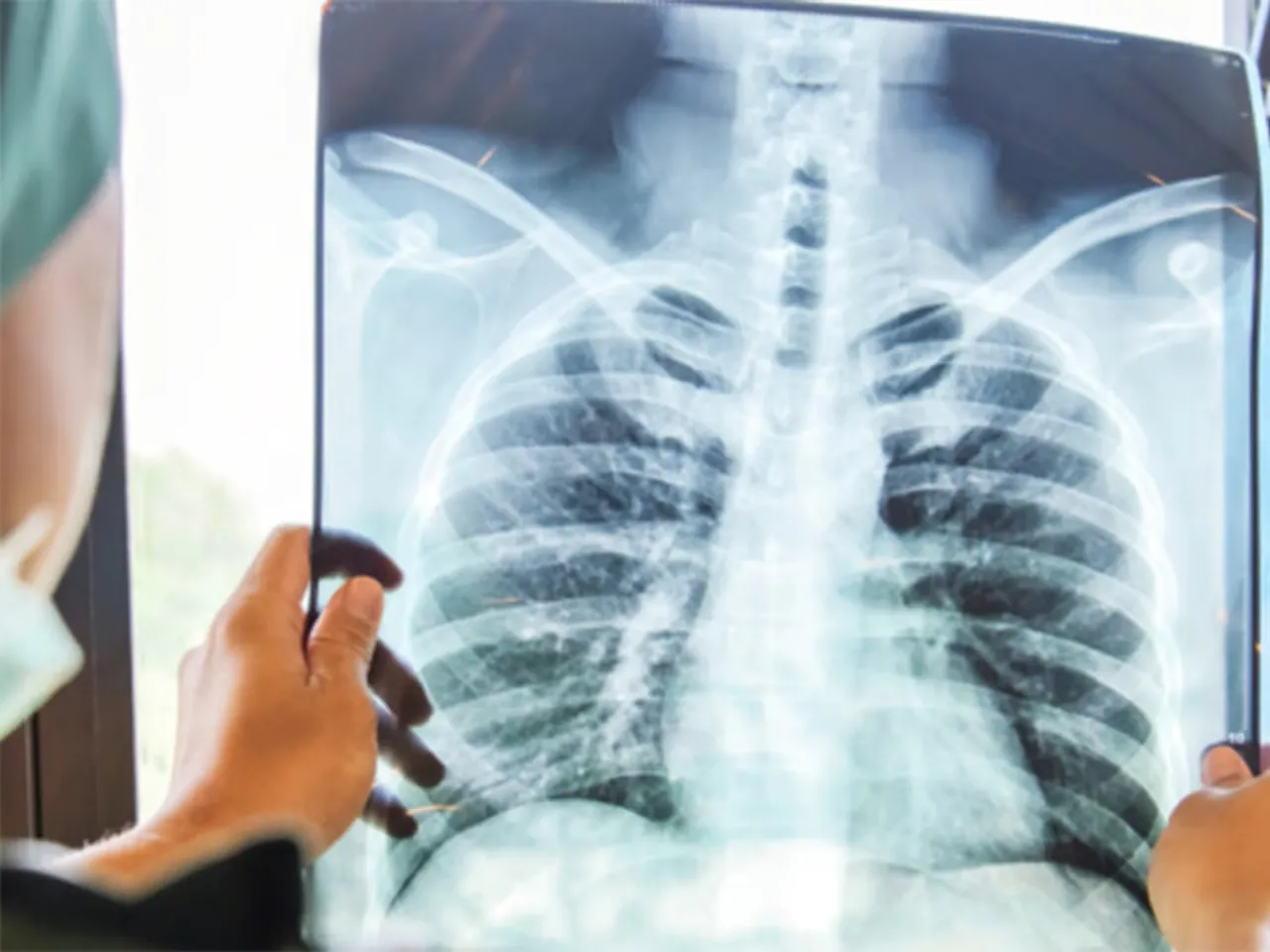 Transforming Moroccan Healthcare: The Role of Artificial Intelligence in a Changing System